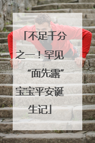 不足千分之一！罕见“面先露”宝宝平安诞生记