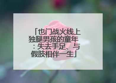 也门战火线上独腿男孩的童年：失去手足、与假肢相伴一生